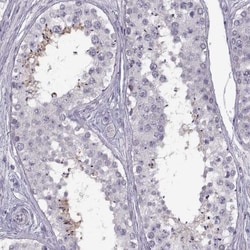 HYPM Antibody, Novus Biologicals:Antibodies:Primary Antibodies